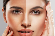 Damaged Skin Barrier