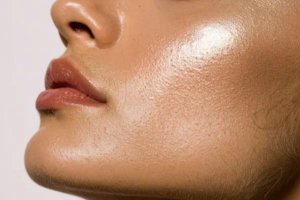 Oily Skin