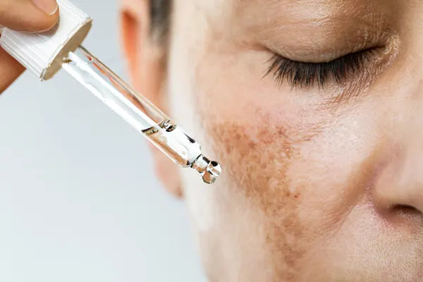 Pigmentation
