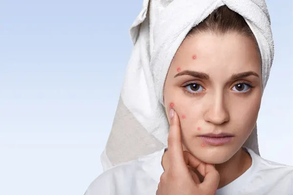 Sensitive Skin